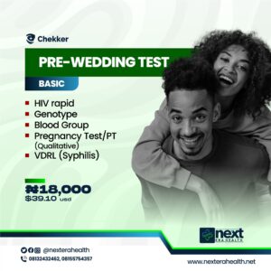 Pre wedding test basic